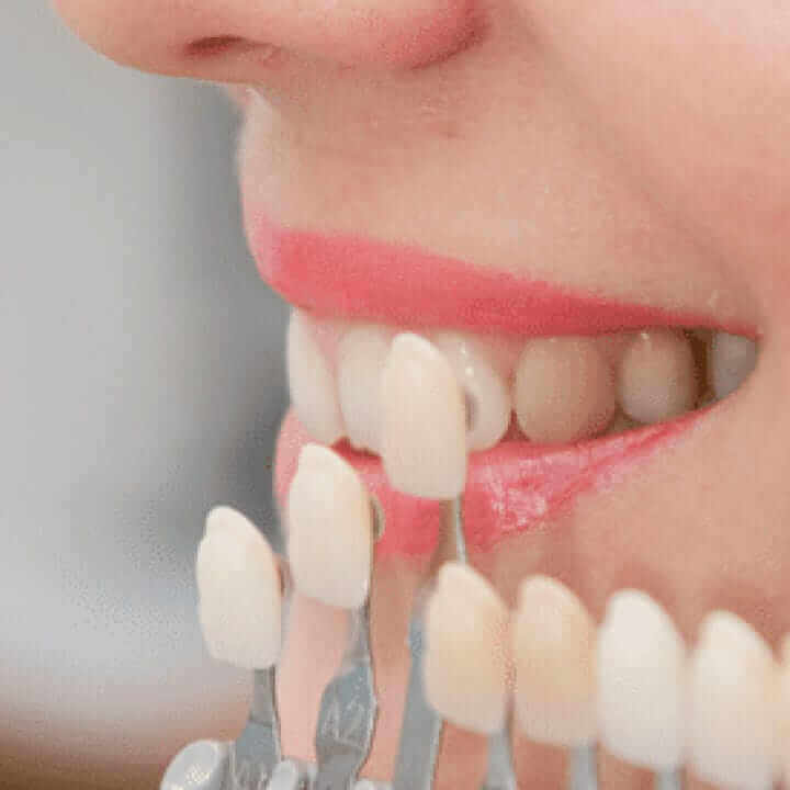 Services Lee Dental Kajang