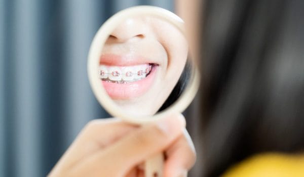 Can you have a beautiful smile without removing some of your teeth?
